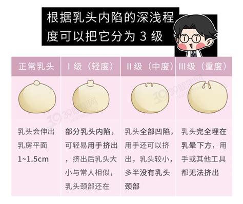 女人的奶頭|乳頭內凹、長毛正常嗎？ 8類「乳頭形狀」你的是哪種